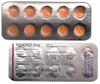 Generic Proscar